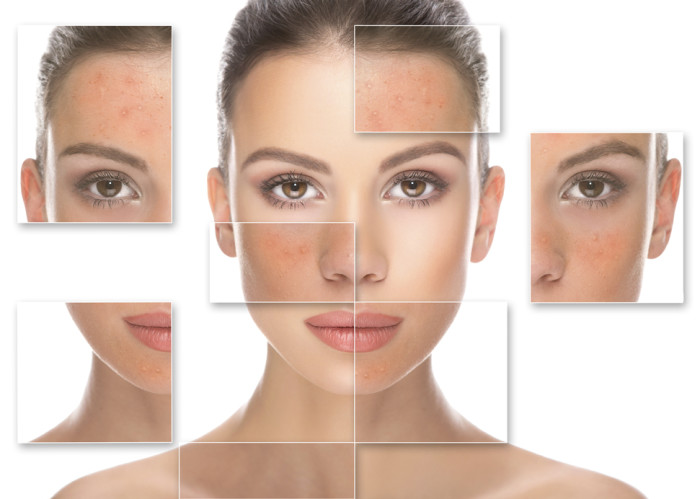 Best facial for sensitve skin by Best Facials Singapore