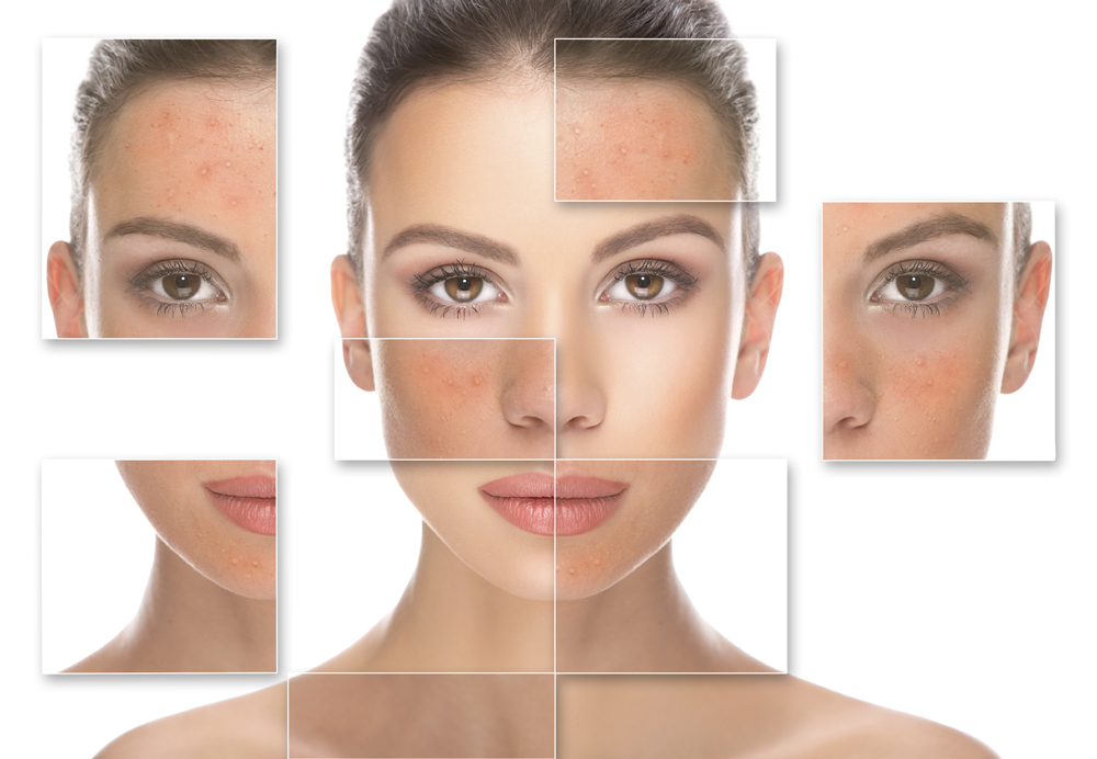 Best facial for sensitve skin by Best Facials Singapore