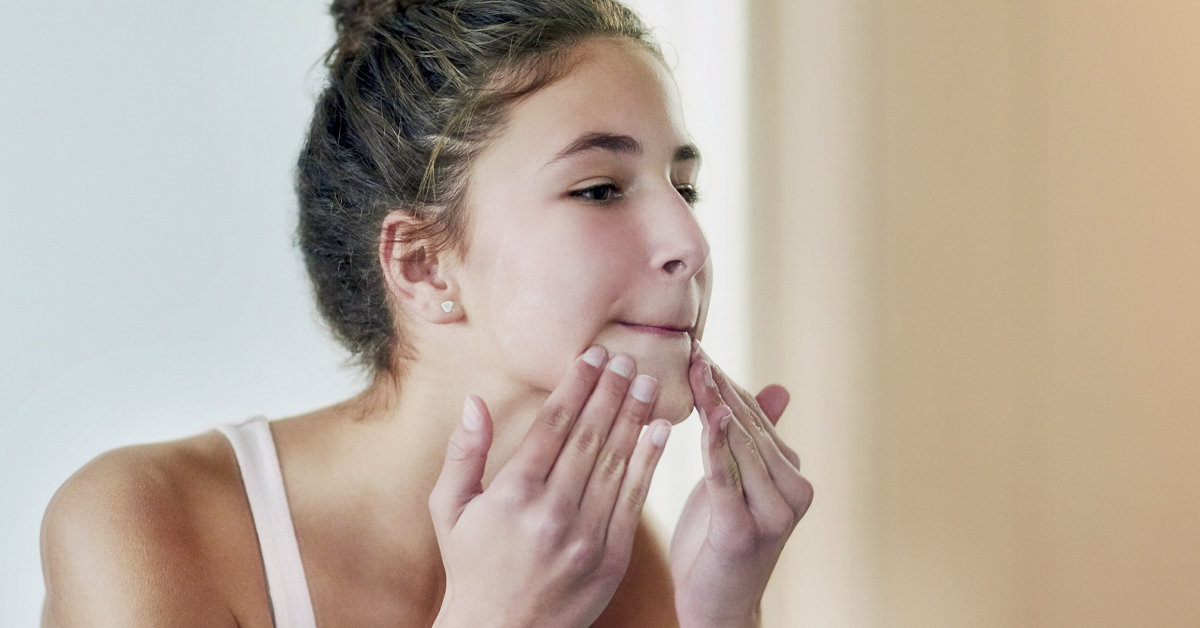 What every teenager should know about pimples6